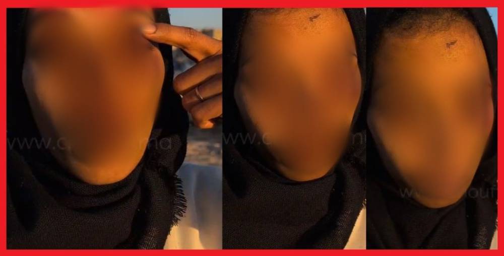 اعتداء خطير على سيدة يقود لتوق