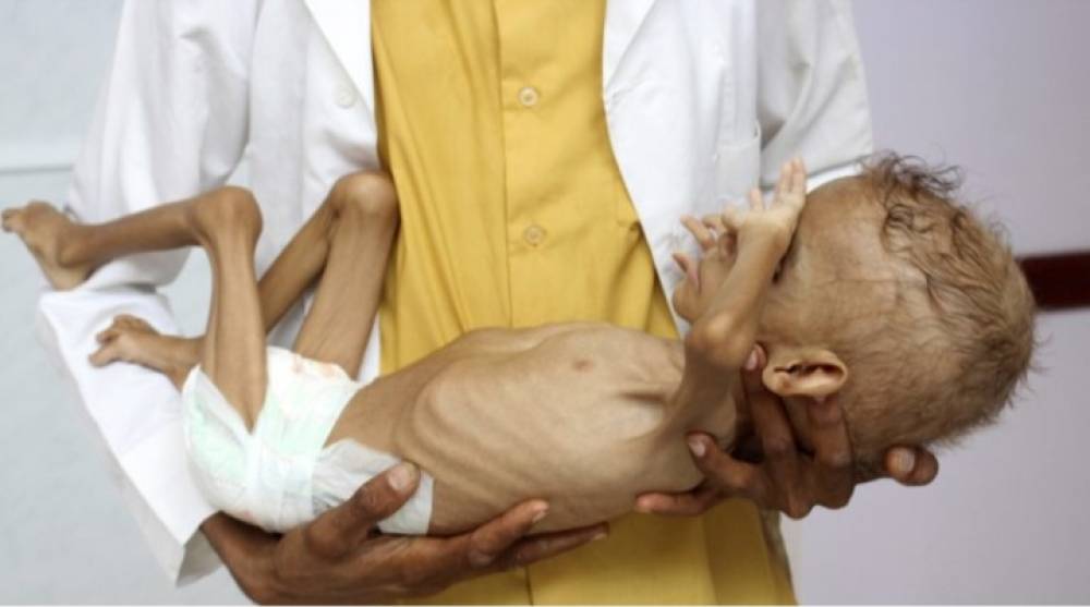 منظمة الصحة العالمية تدق ناقوس خطر تفشي “الكوليرا”
