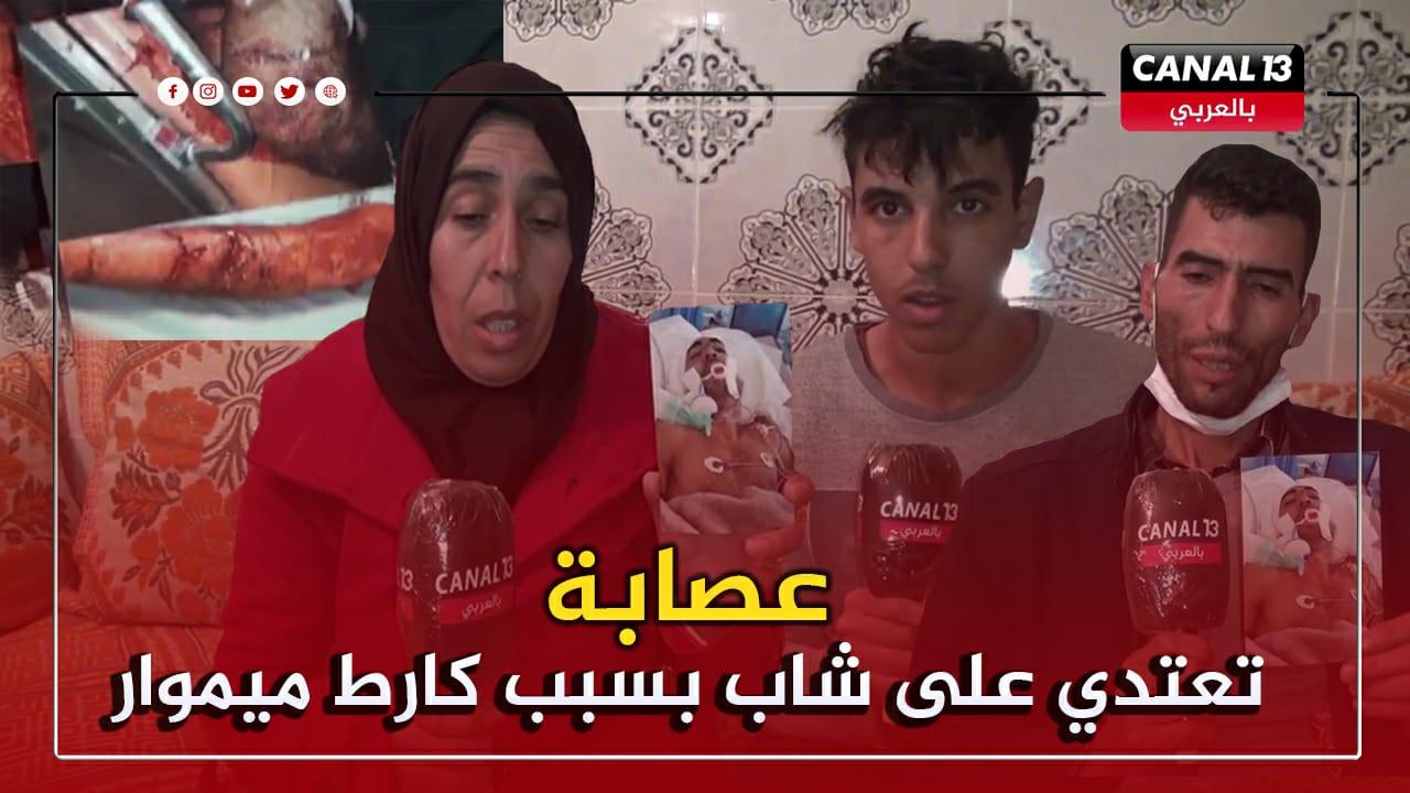 خطير.. بسبب "كارط ميموار" عصابة شرملو شاب بإقليم تاونات وصفطوه بين الحياة والموت للمستعجلات